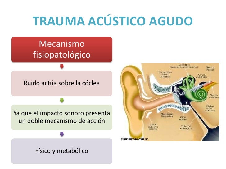 trauma acustico agudo